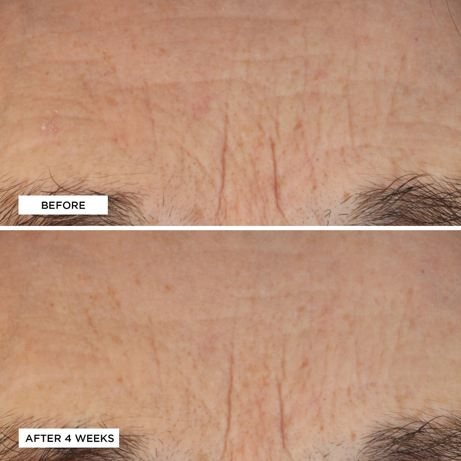 PERRICONE MD Essential Fx Acyl-Glutathione Deep Crease Serum