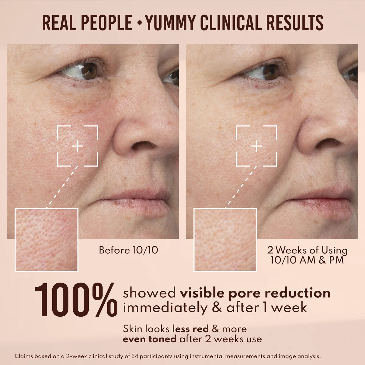 Купить DANESSA MYRICKS Beauty Yummy Skin 10/10 BARRIER BOOST HA + Ectoin Plumping Serum на Beautystorage.ru. Быстрая доставка по России и СНГ.