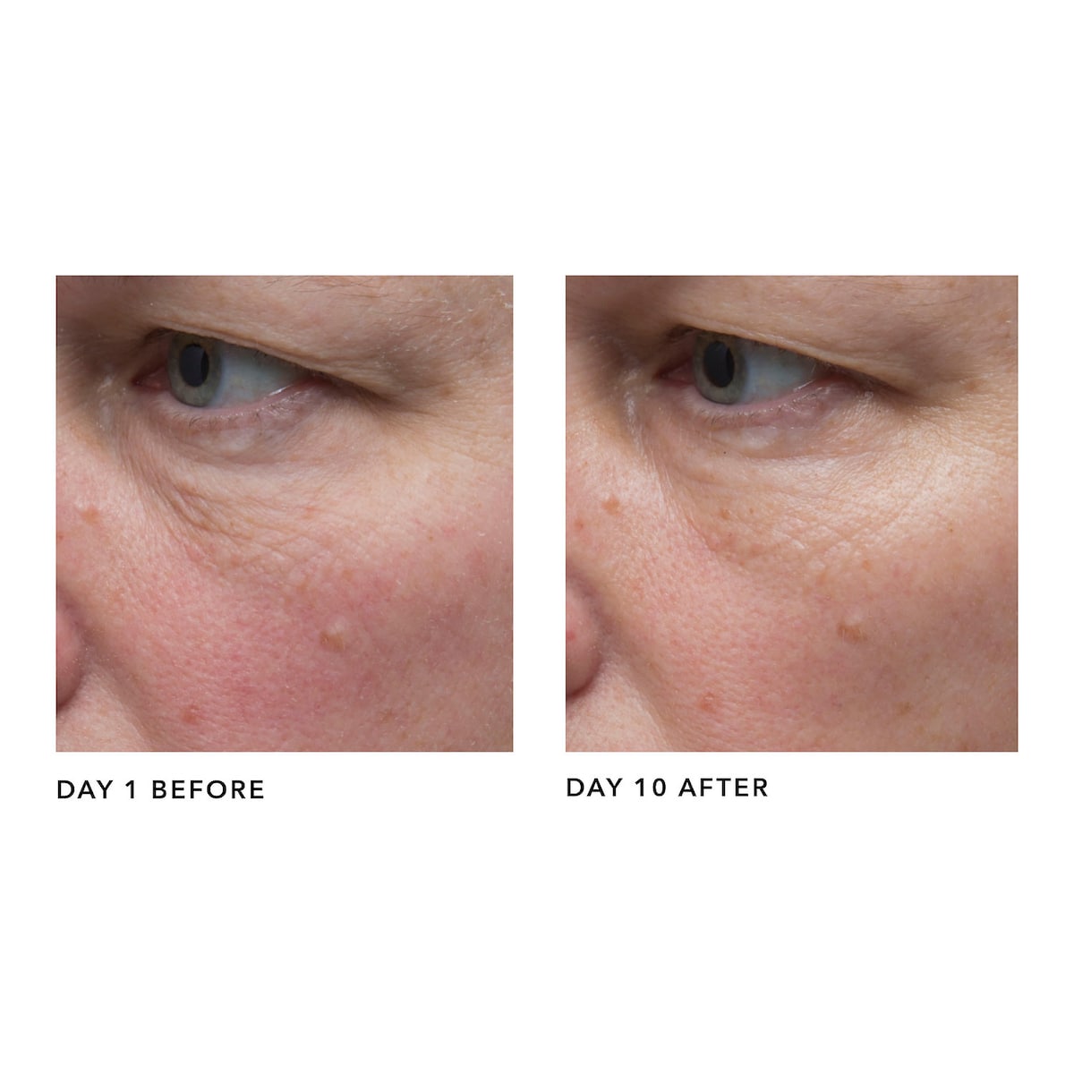 ALGENIST GENIUS Liquid Collagen купить в Beauty Storage. Быстрая доставка по России и СНГ.