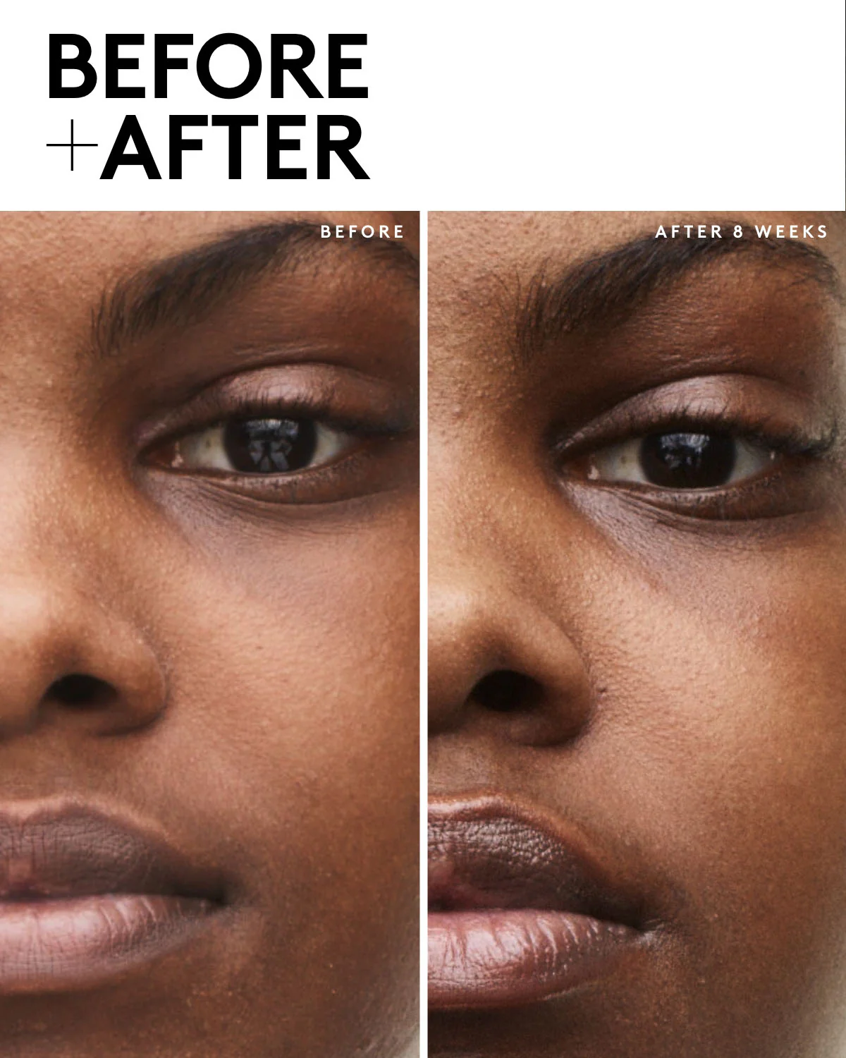 FENTY SKIN Travel-Size Start'r Set With Mineral Spf: Dry Skin Edition