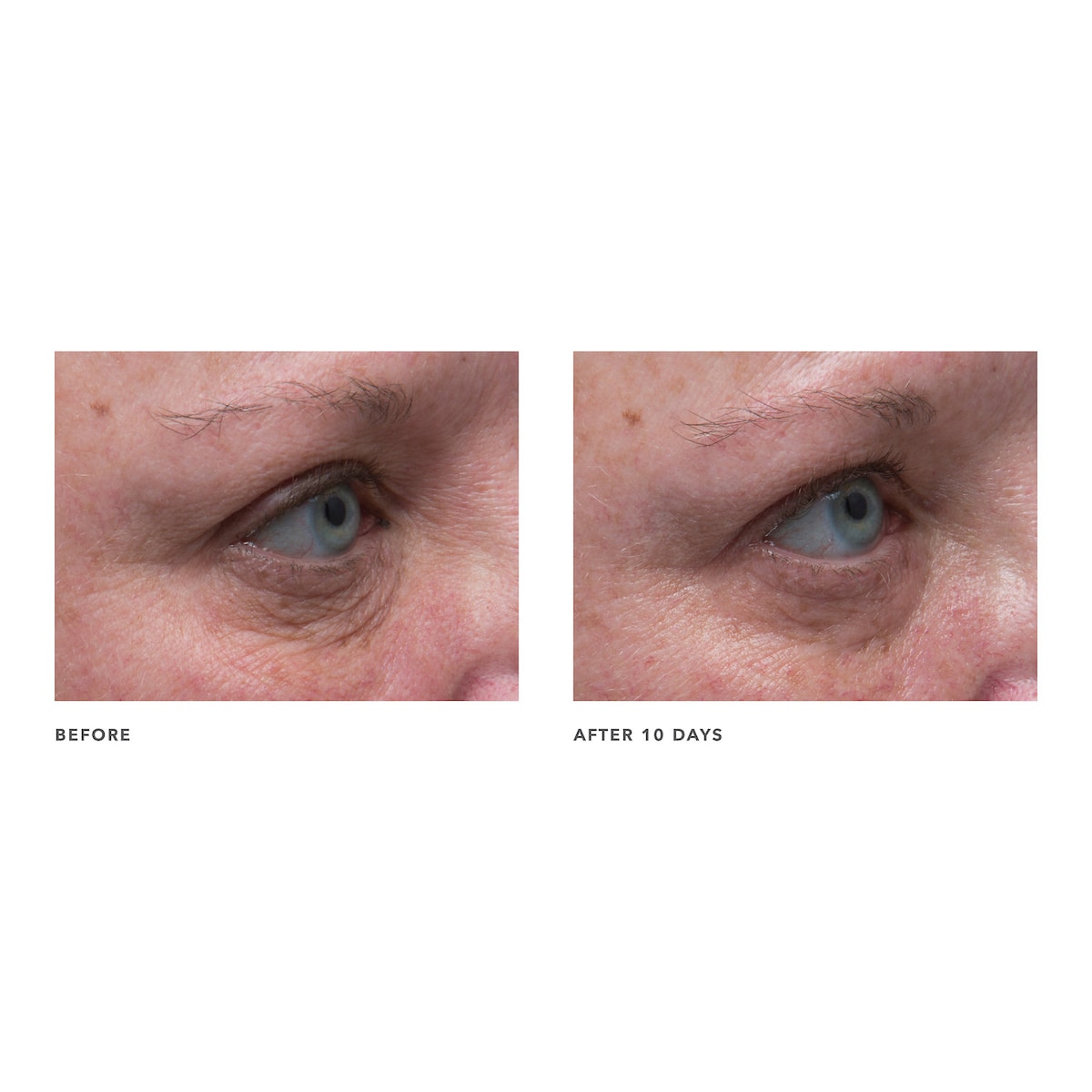 ALGENIST ELEVATE Firming & Lifting Contouring Eye Cream купить в Beauty Storage. Быстрая доставка по России и СНГ.