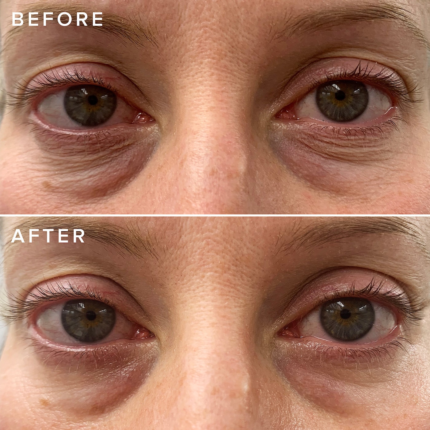 FARMACY Cheer Up Brightening Vitamin C Eye Cream with Acerola Cherry купить в Beauty Storage. Быстрая доставка по России и СНГ.
