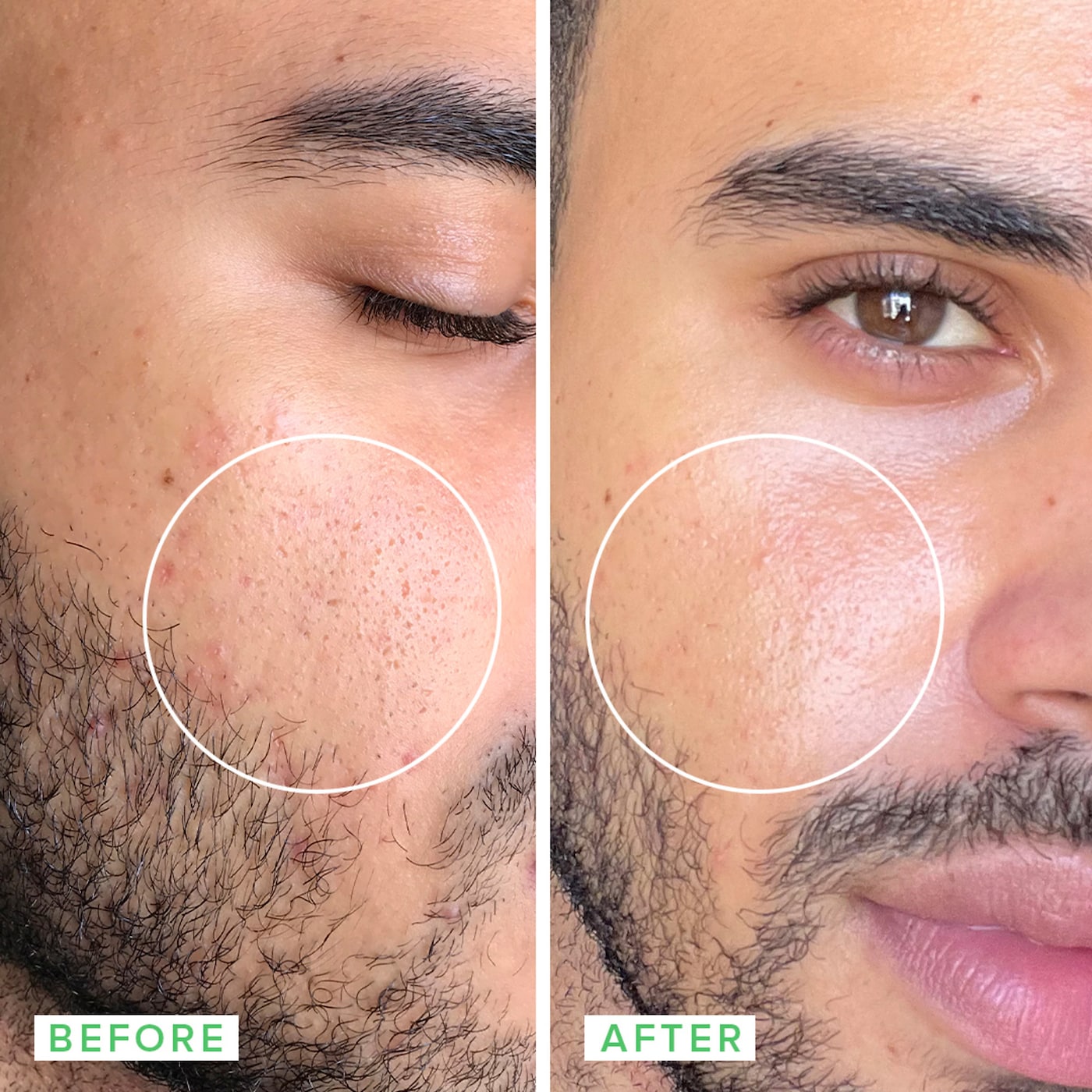 FARMACY Deep Sweep 2% BHA Pore Cleaning Toner with Moringa + Papaya купить в Beauty Storage. Быстрая доставка по России и СНГ.