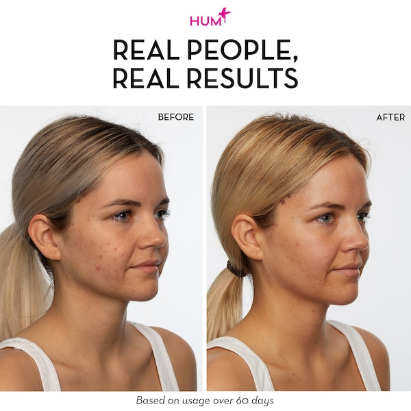 HUM NUTRITION Skin Squad™ Pre + Probiotic Clear Skin Supplement купить в Beauty Storage. Быстрая доставка по России и СНГ.