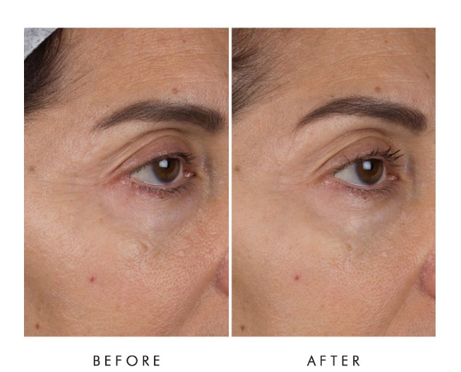 ALPHA-H Liquid Gold Firming Eye Cream