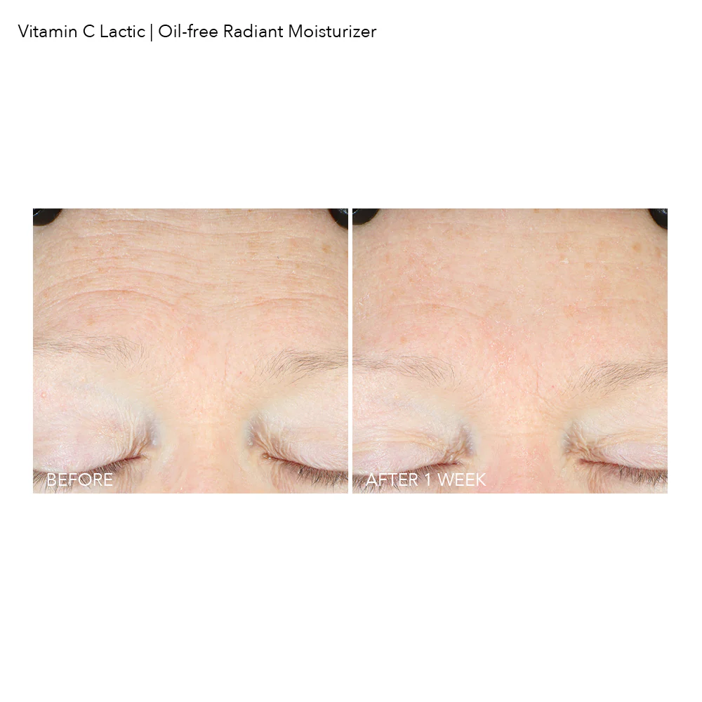 DR. DENNIS GROSS Vitamin C Lactic Oil-Free Radiant Moisturizer купить в Beauty Storage. Быстрая доставка по России и СНГ.