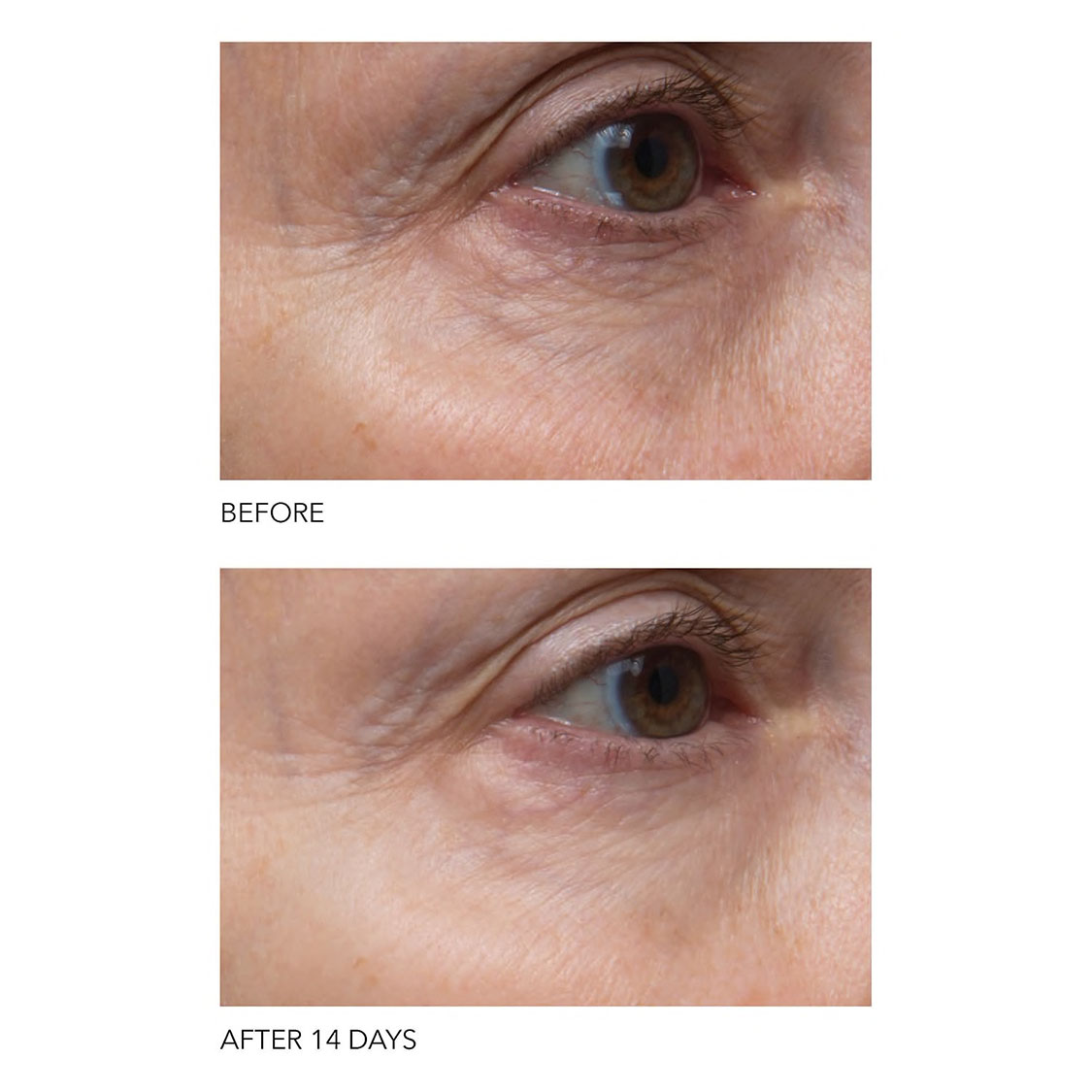 DR. DENNIS GROSS SKINCARE Vitamin C+ Collagen Brighten & Firm Eye Cream