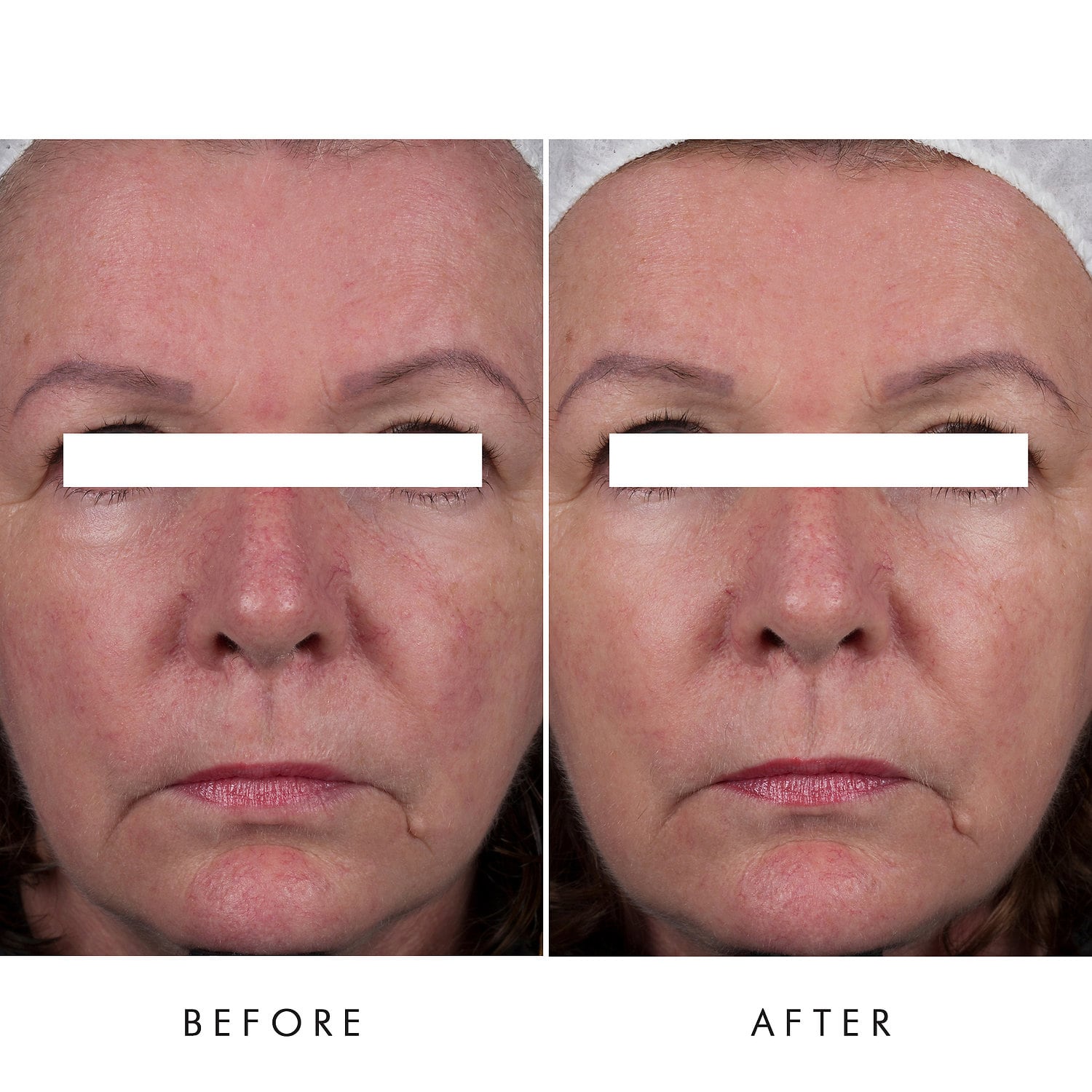 ALPHA-H Essential Hydration Cream