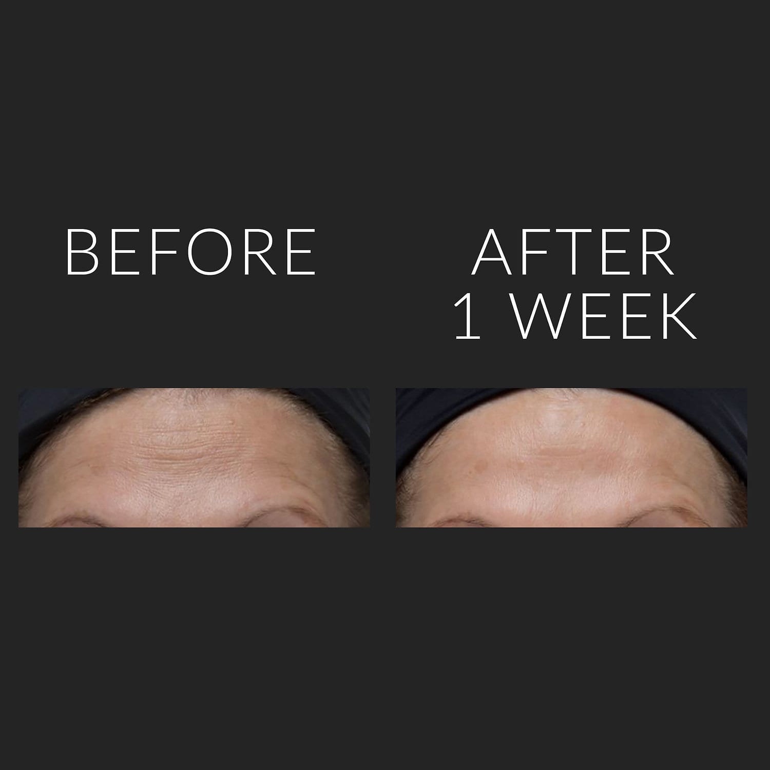 KATE SOMERVILLE ExfoliKate Glow Moisturizer