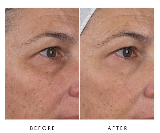 ALPHA-H Liquid Gold Firming Eye Cream