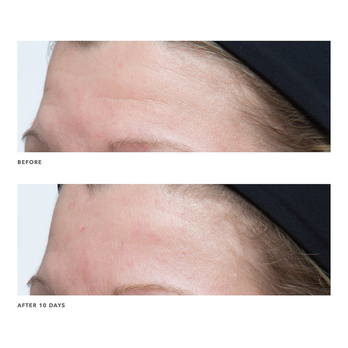 ALGENIST GENIUS Ultimate Anti-Aging Cream купить в Beauty Storage. Быстрая доставка по России и СНГ.