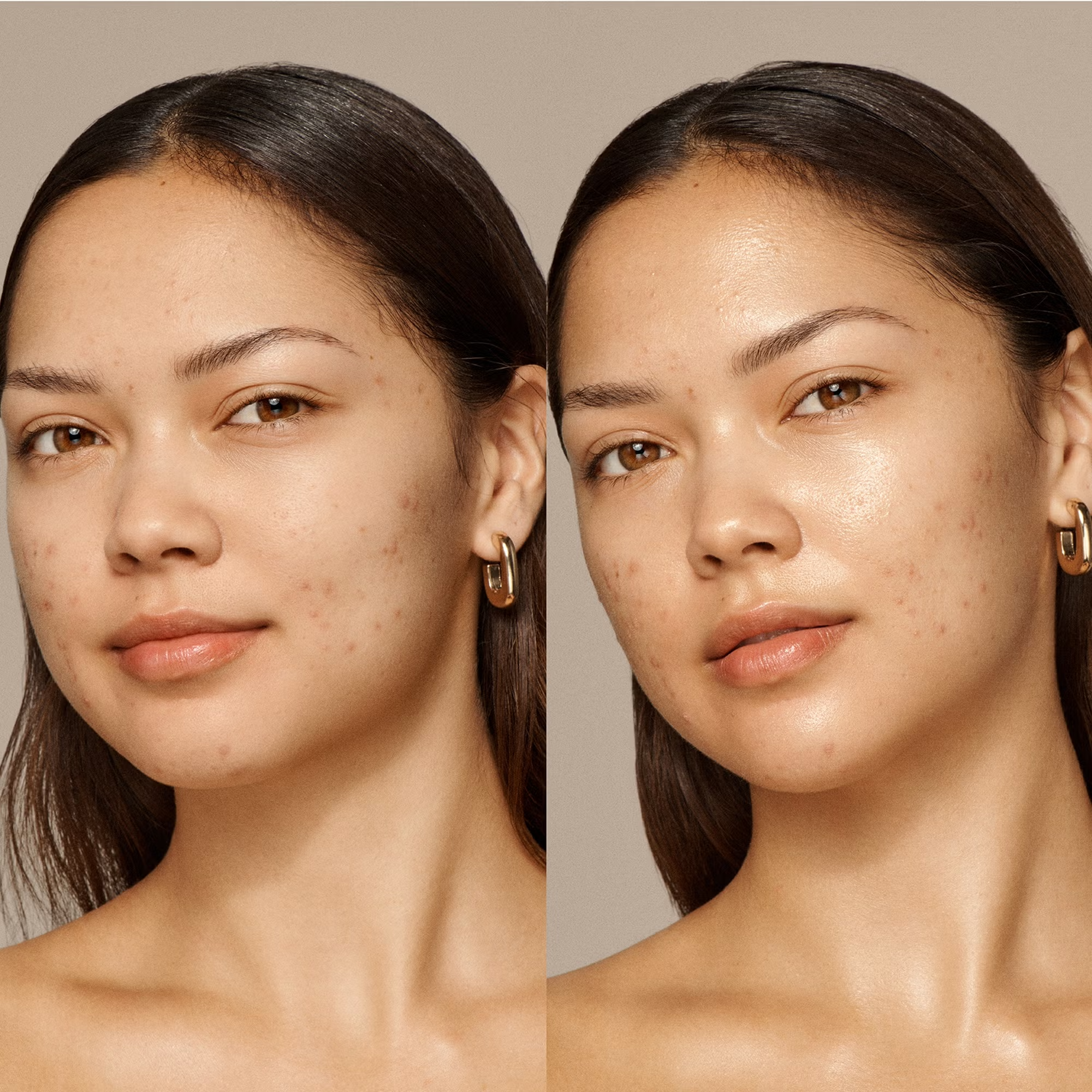 VIEVE Skin Nova купить в Beauty Storage. Быстрая доставка по России и СНГ.