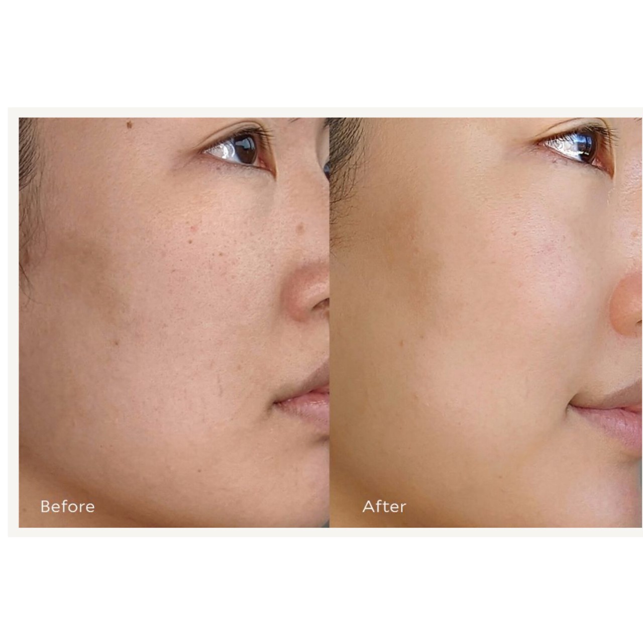 TATA HARPER Resurfacing AHA + BHA Serum купить в Beauty Storage. Быстрая доставка по России и СНГ.