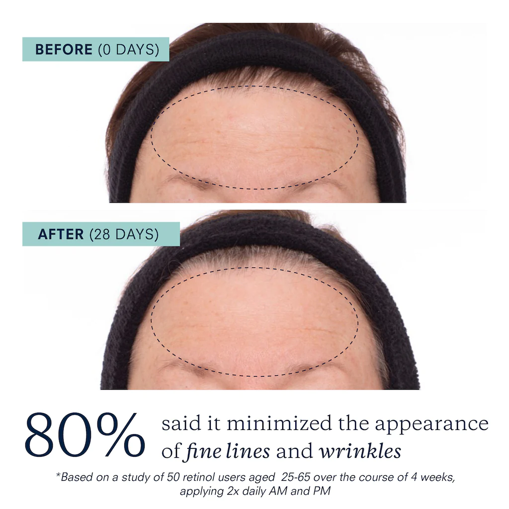 KORA ORGANICS Plant Stem Cell Retinol Alternative Serum купить в Beauty Storage. Быстрая доставка по России и СНГ.