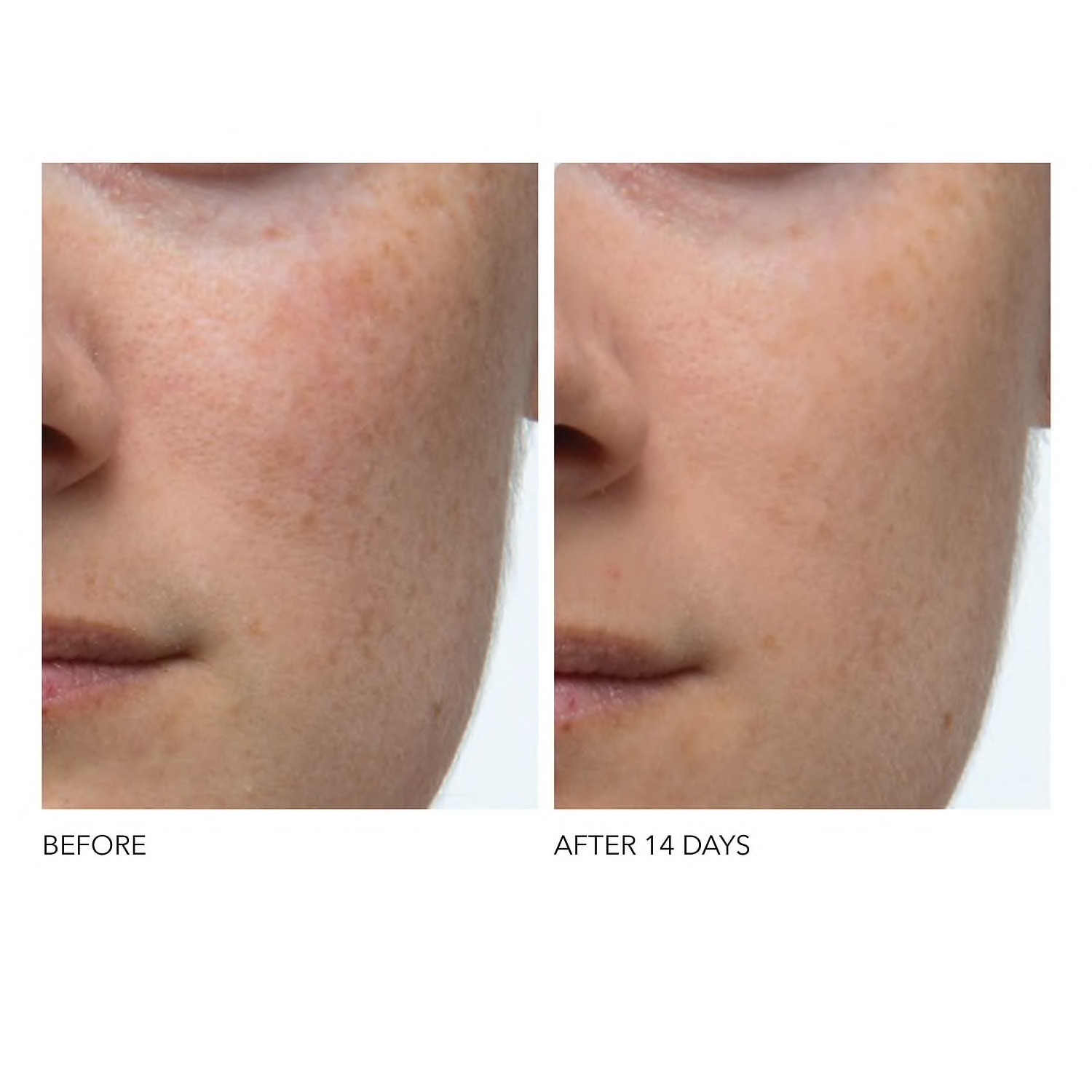 DR. DENNIS GROSS SKINCARE Alpha Beta® Extra Strength Daily Peel