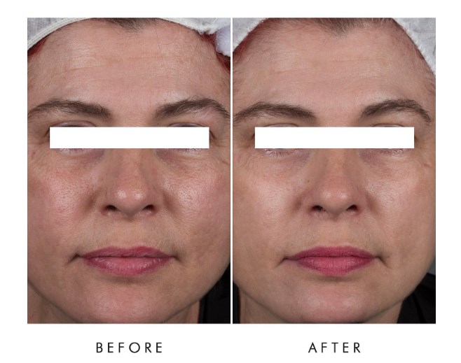 ALPHA-H Liquid Gold Ultimate Perfecting Mask