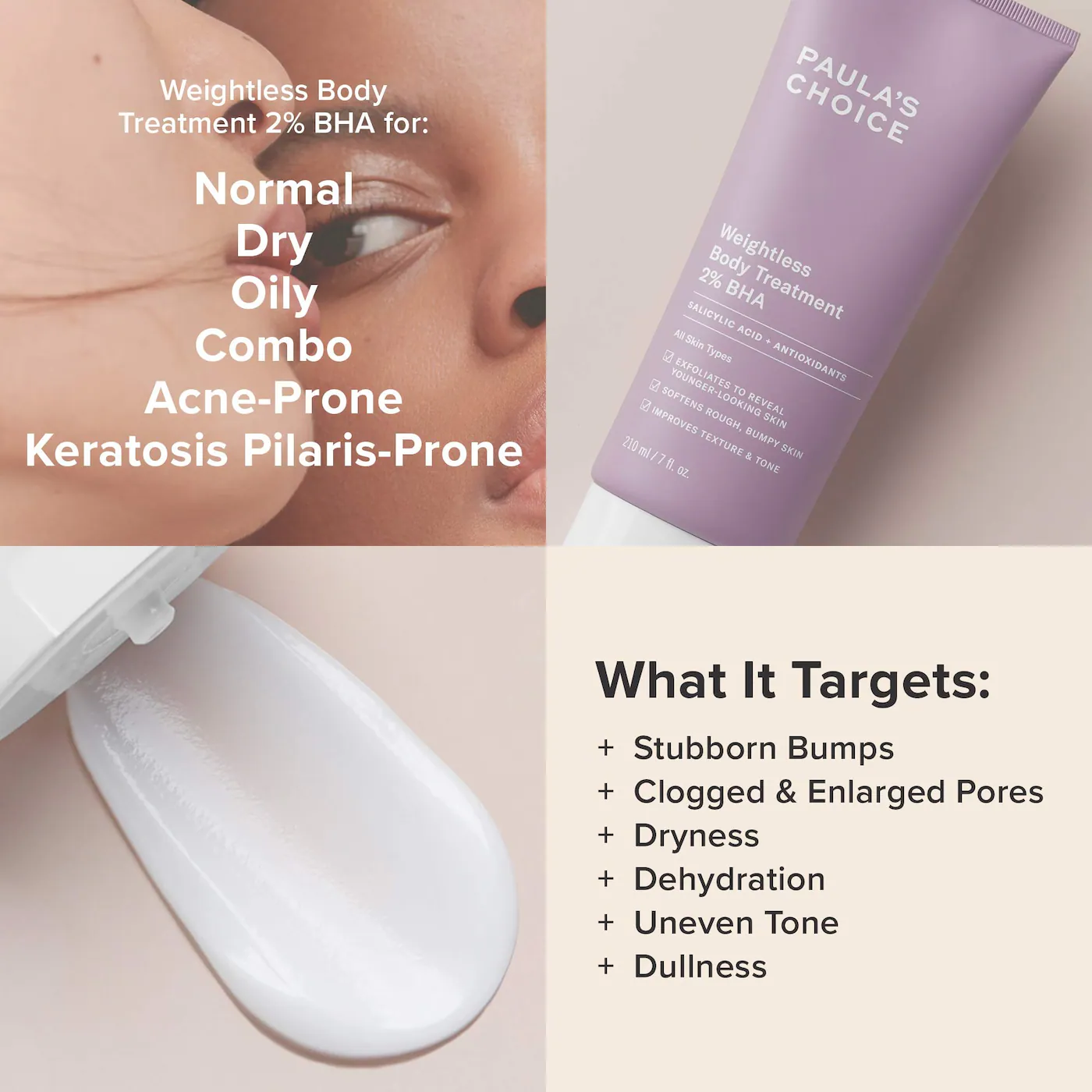 PAULA'S CHOICE Weightless Body Treatment 2% BHA купить в Beauty Storage. Быстрая доставка по России и СНГ.
