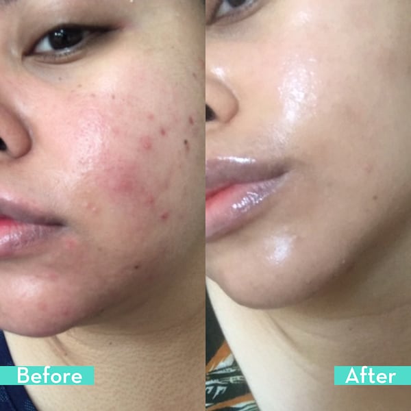 HUM NUTRITION Daily Cleanse Clear Skin and Body Detox Supplement купить в Beauty Storage. Быстрая доставка по России и СНГ.