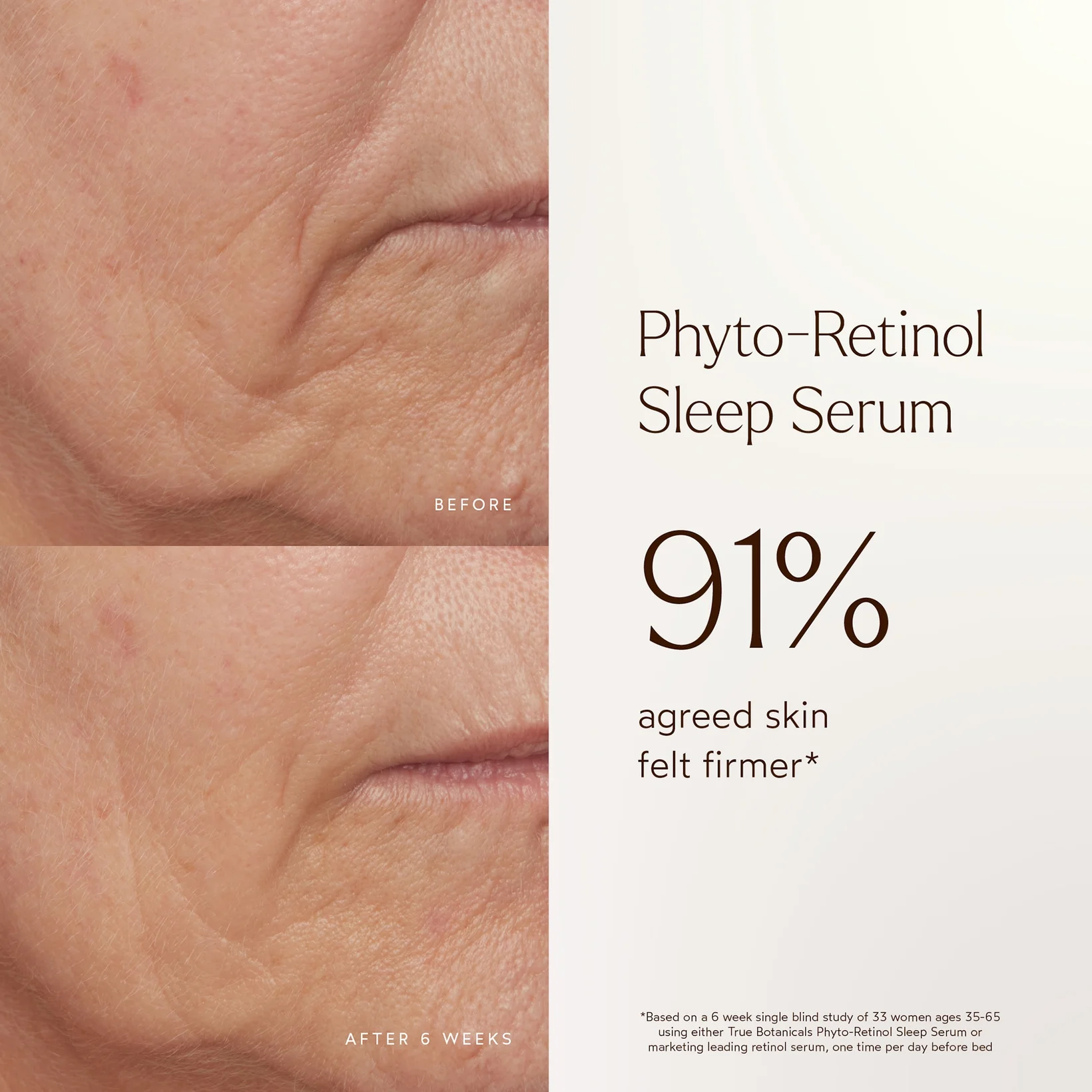 Купить TRUE BOTANICALS Phyto-Retinol Anti-Aging Sleep Serum на Beautystorage.ru. Быстрая доставка по России и СНГ.
