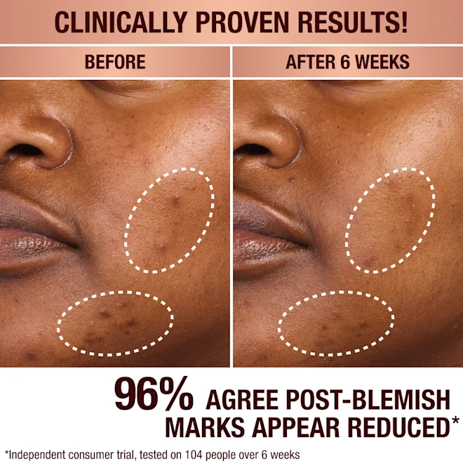 CHARLOTTE TILBURY Dark Spot Correcting Radiance Recovery Serum купить в Beauty Storage. Быстрая доставка по России и СНГ.