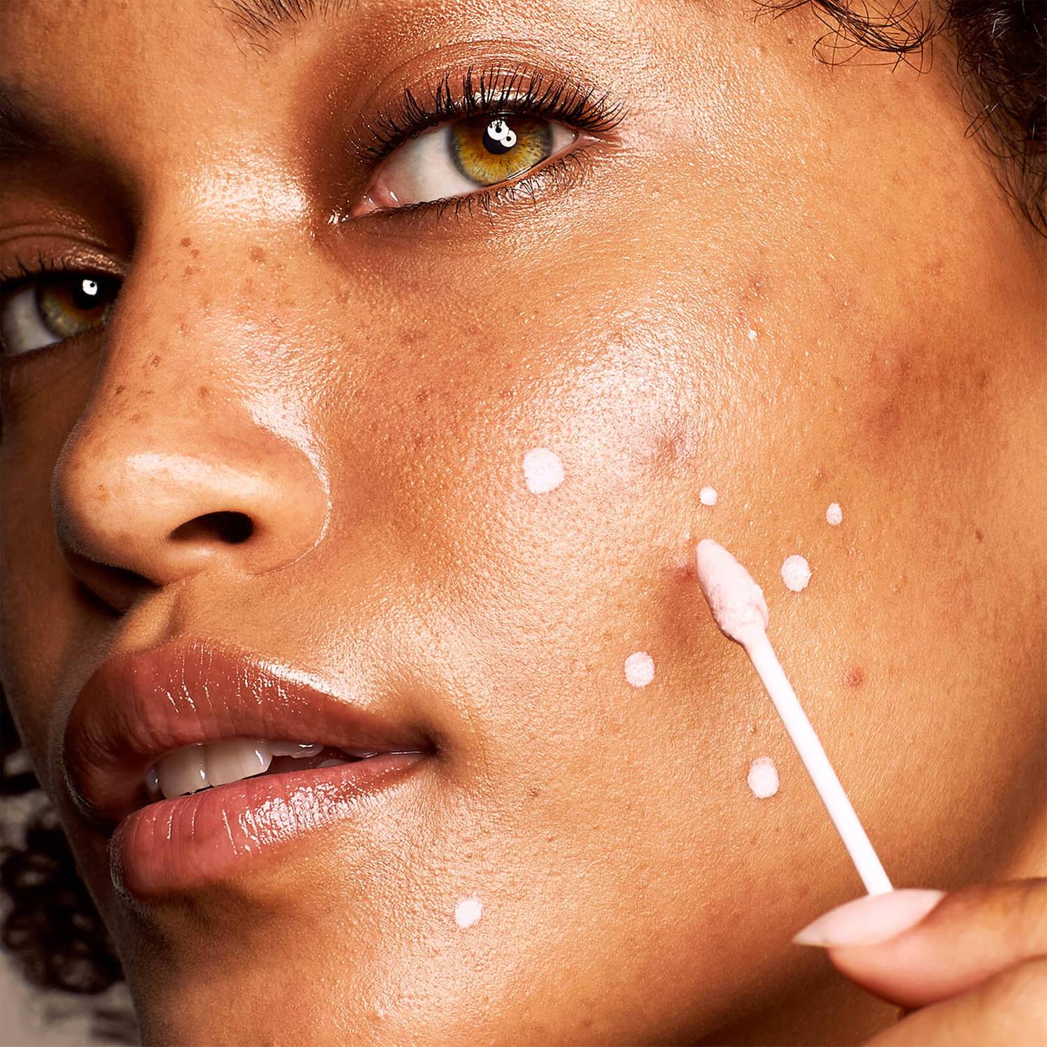 KATE SOMERVILLE EradiKate® 10% Sulfur Blemish Treatment купить в Beauty Storage. Быстрая доставка по России и СНГ.