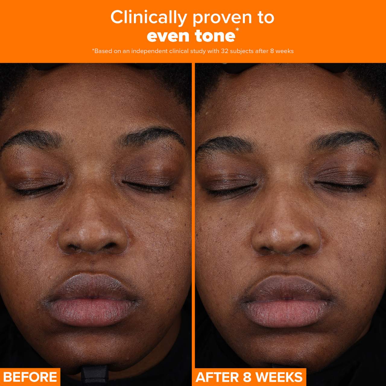 PAULA'S CHOICE 25% Vitamin C + Glutathione Clinical Serum  купить в Beauty Storage. Быстрая доставка по России и СНГ.