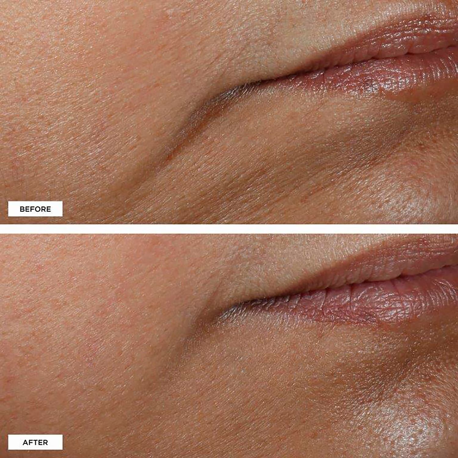 PERRICONE MD Multi-Action Overnight Intensive Firming Mask