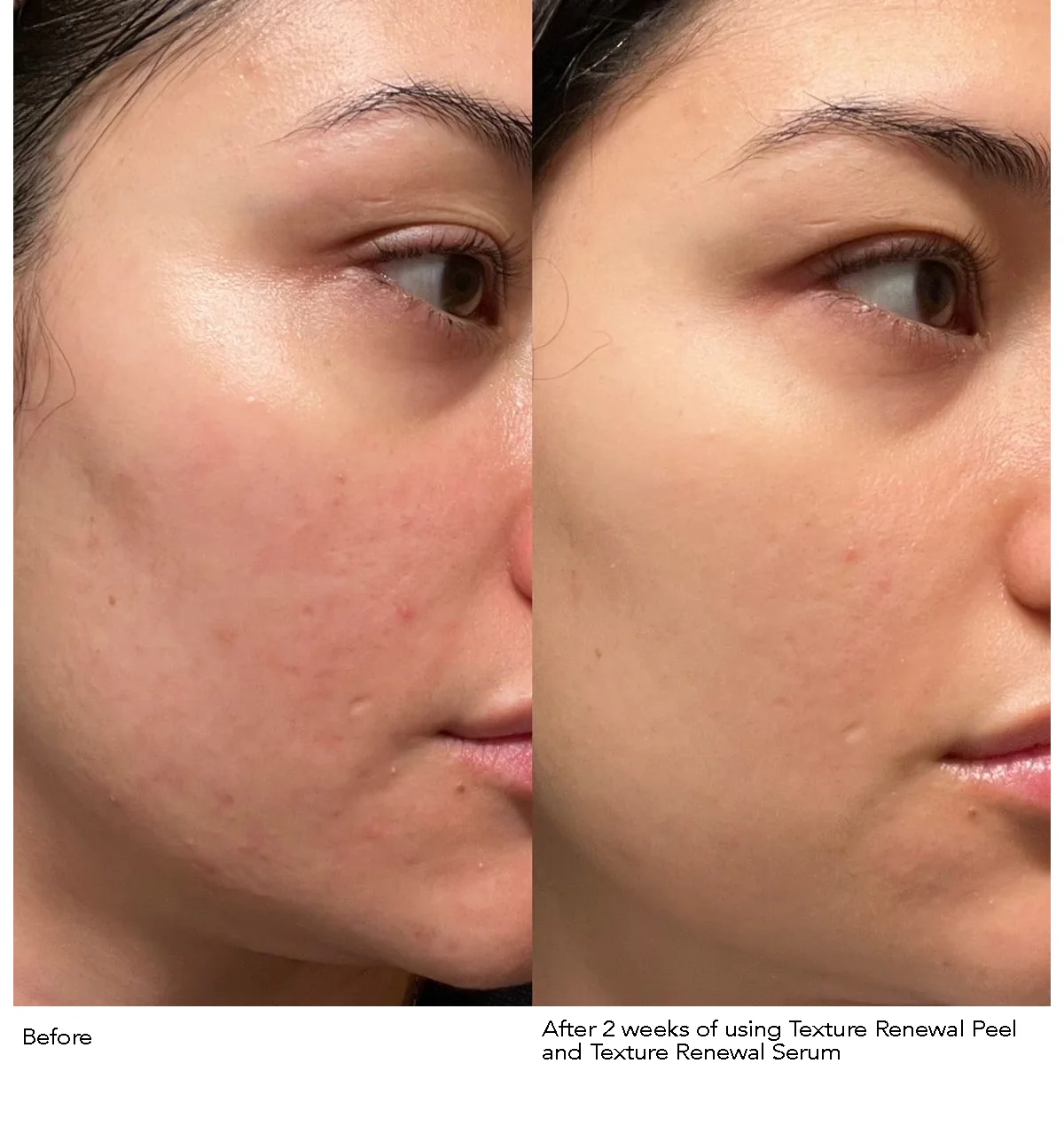 DR. DENNIS GROSS Advanced Retinol + Ferulic Texture Renewal Serum купить в Beauty Storage. Быстрая доставка по России и СНГ.