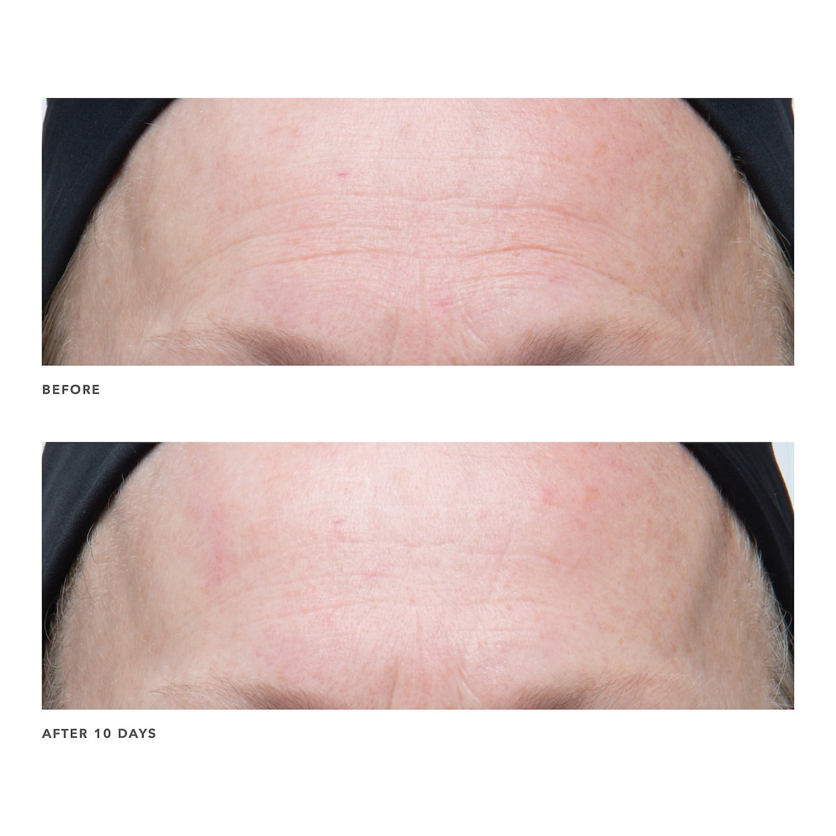 ALGENIST GENIUS Ultimate Anti-Aging Vitamin C+ Serum купить в Beauty Storage. Быстрая доставка по России и СНГ.