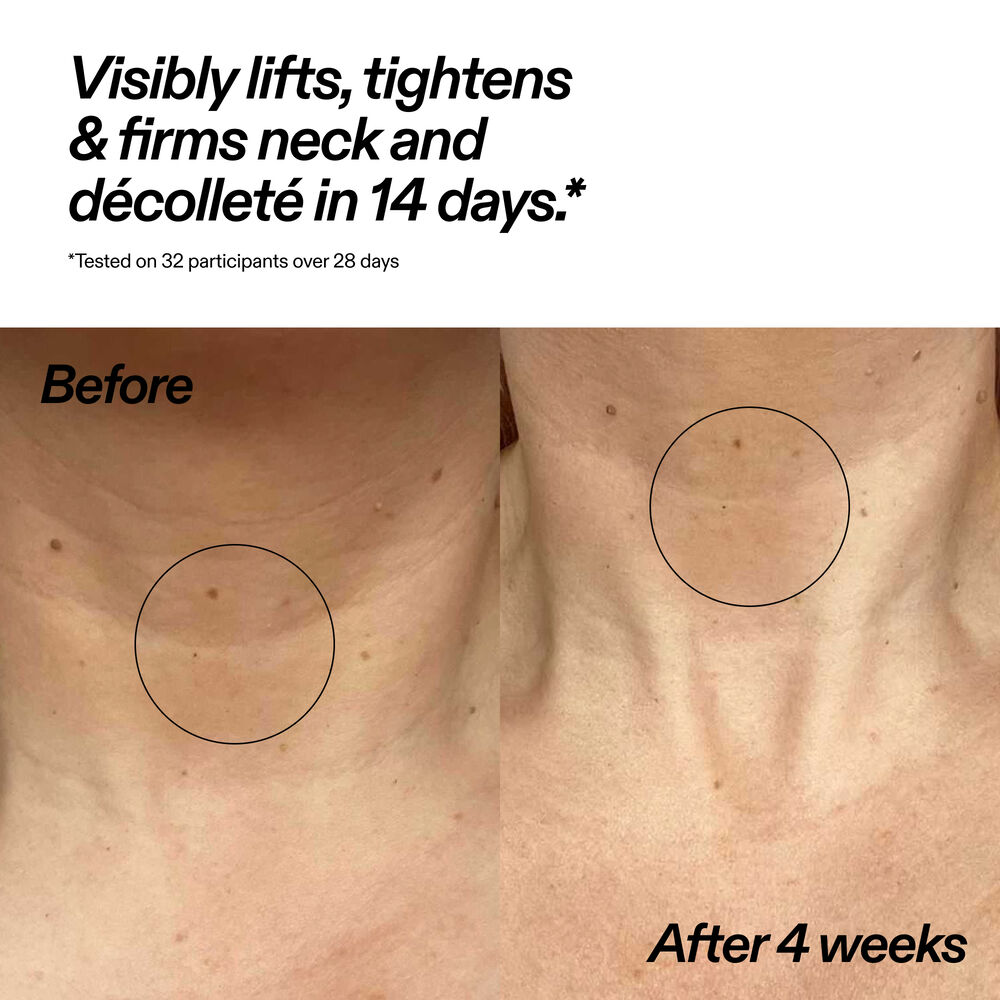 Купить The INKEY List Bio-active Ceramide Neck Stick на Beautystorage.ru. Быстрая доставка по России и СНГ.