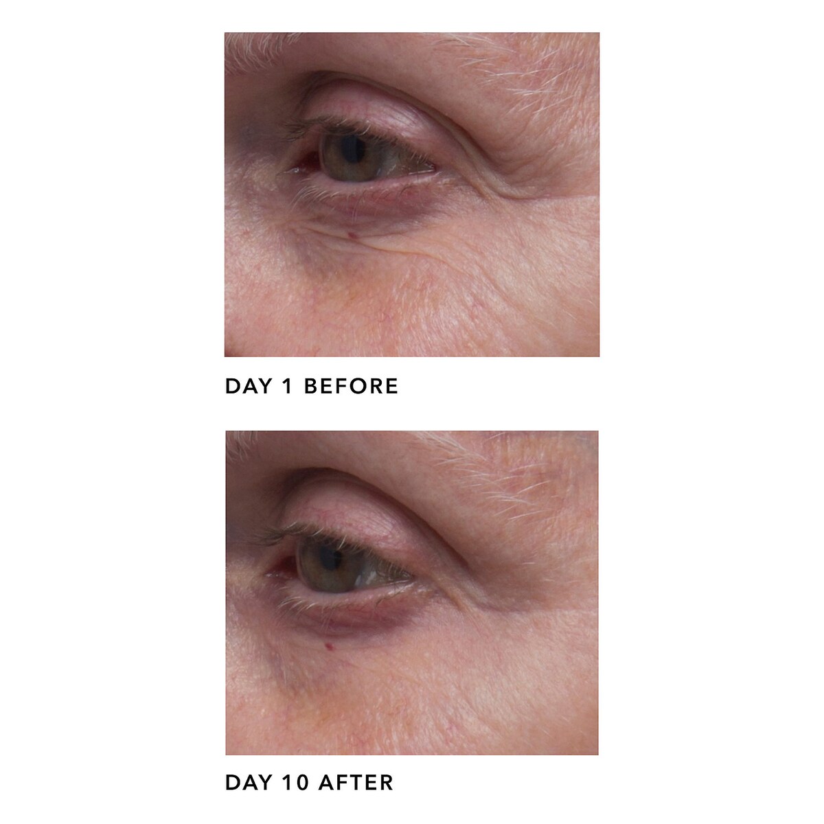 ALGENIST AA (Alguronic Acid) Barrier Serum купить в Beauty Storage. Быстрая доставка по России и СНГ.
