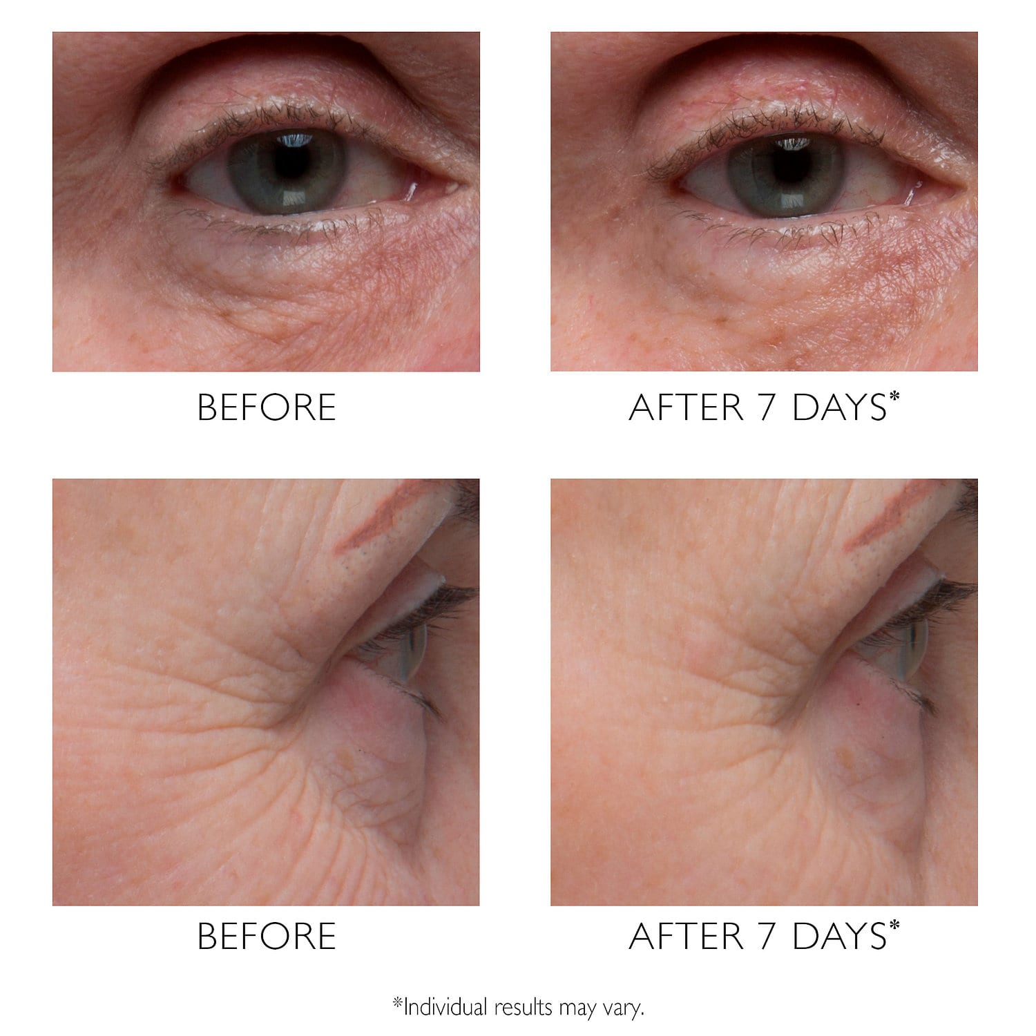 PETER THOMAS ROTH Potent-C™ Vitamin C Power Eye Cream