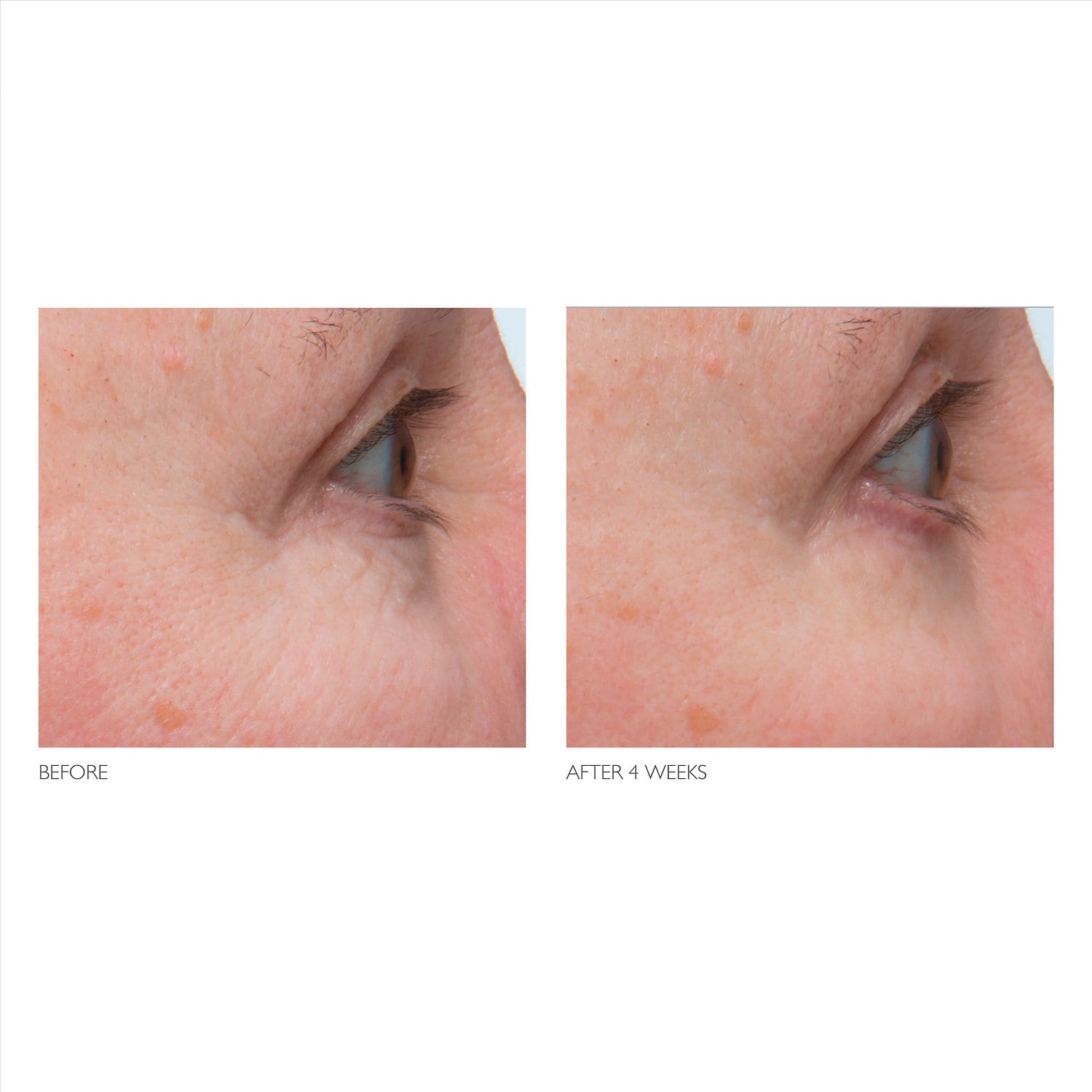 KATE SOMERVILLE Retinol Firming Eye Cream