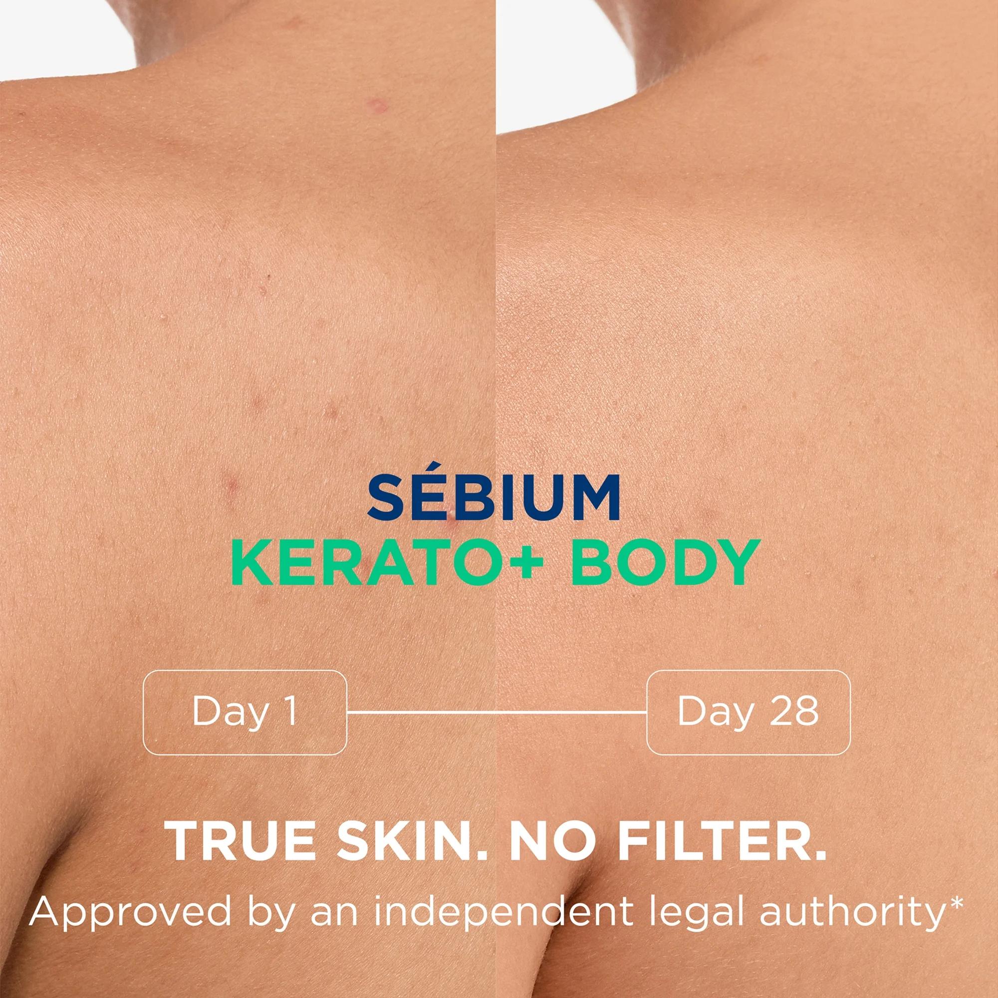 Купить BIODERMA Sebium Kerato+ Body Spray на Beautystorage.ru. Быстрая доставка по России и СНГ.
