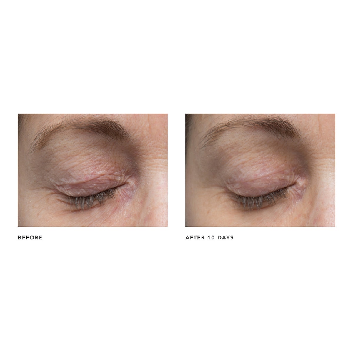 ALGENIST POWER Advanced Wrinkle Fighter 360° Eye Serum купить в Beauty Storage. Быстрая доставка по России и СНГ.