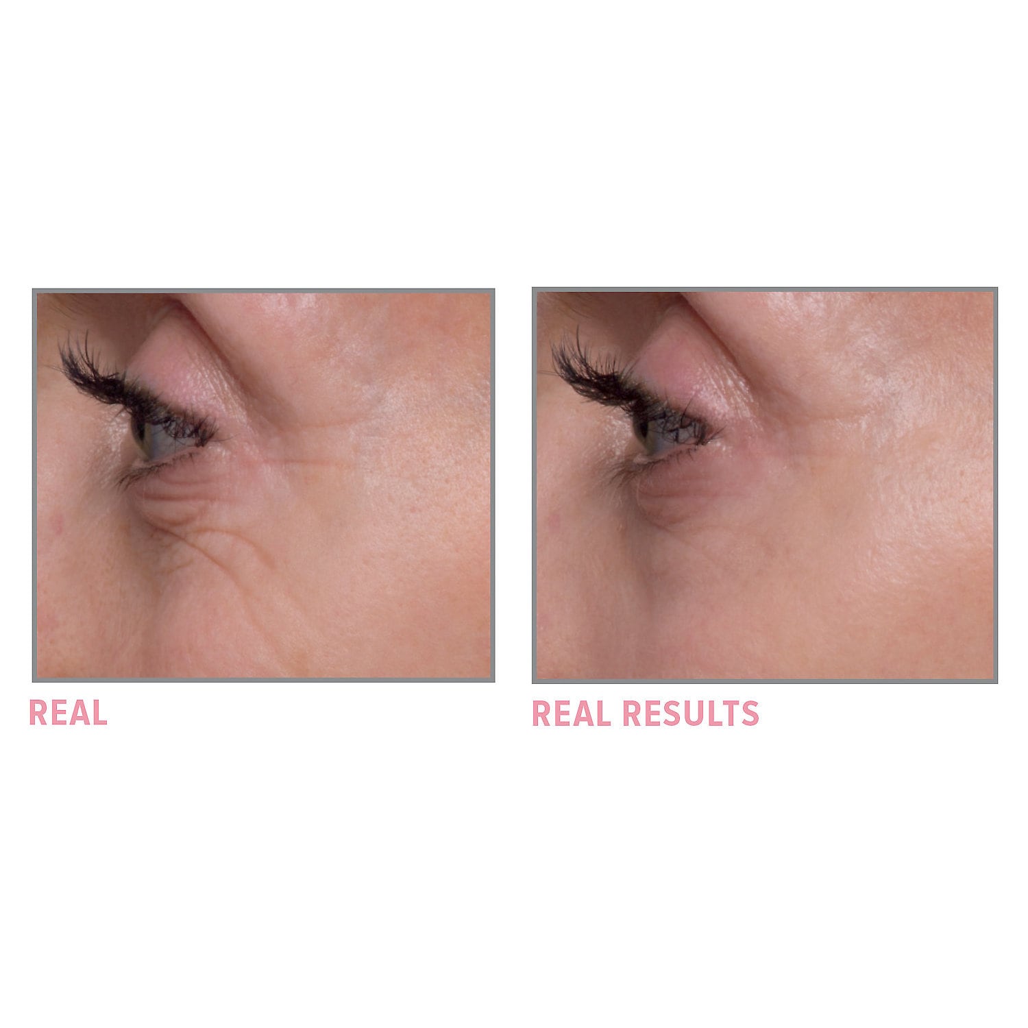 IT COSMETICS Bye Bye Under Eye Brightening Eye Cream купить в Beauty Storage.  Быстрая доставка по России и СНГ.