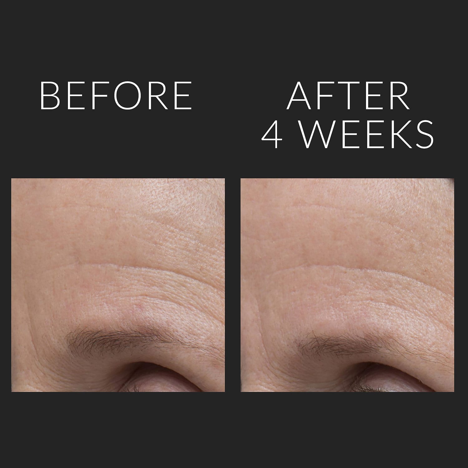 KATE SOMERVILLE DermalQuench Liquid Lift™ + Retinol Advanced Resurfacing Treatment