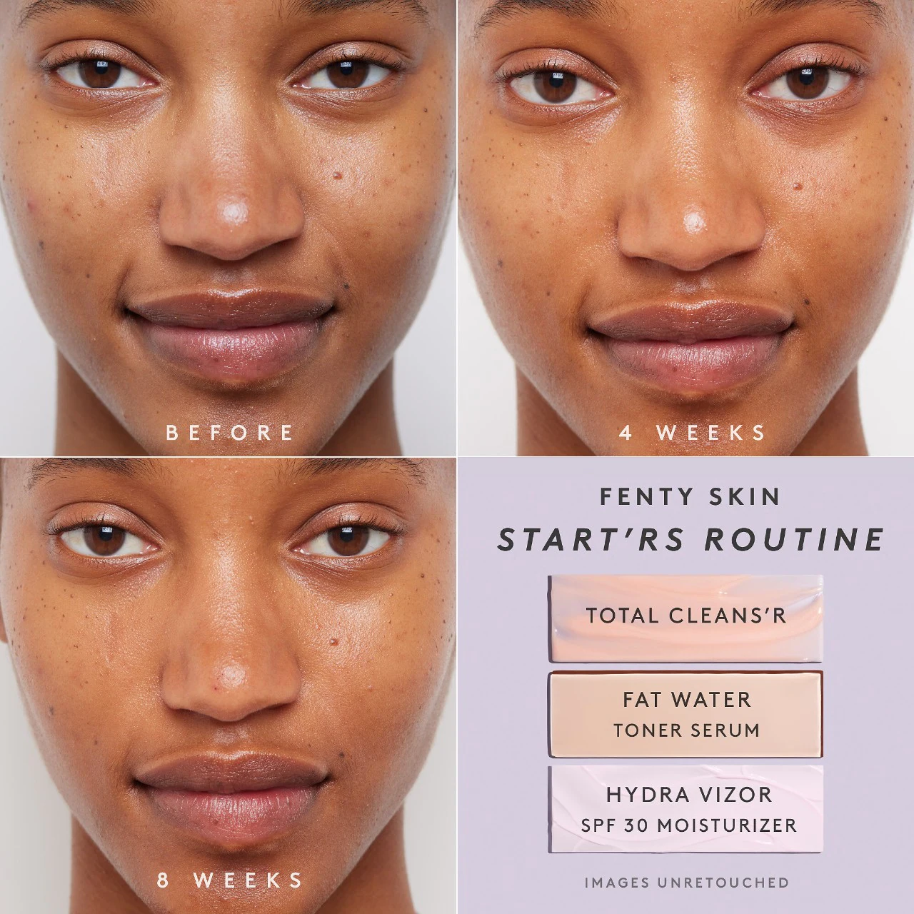 FENTY BEAUTY By Rihanna Total Cleans'r Remove-It-All Cleanser with Barbados Cherry купить в Beauty Storage. Быстрая доставка по России и СНГ.