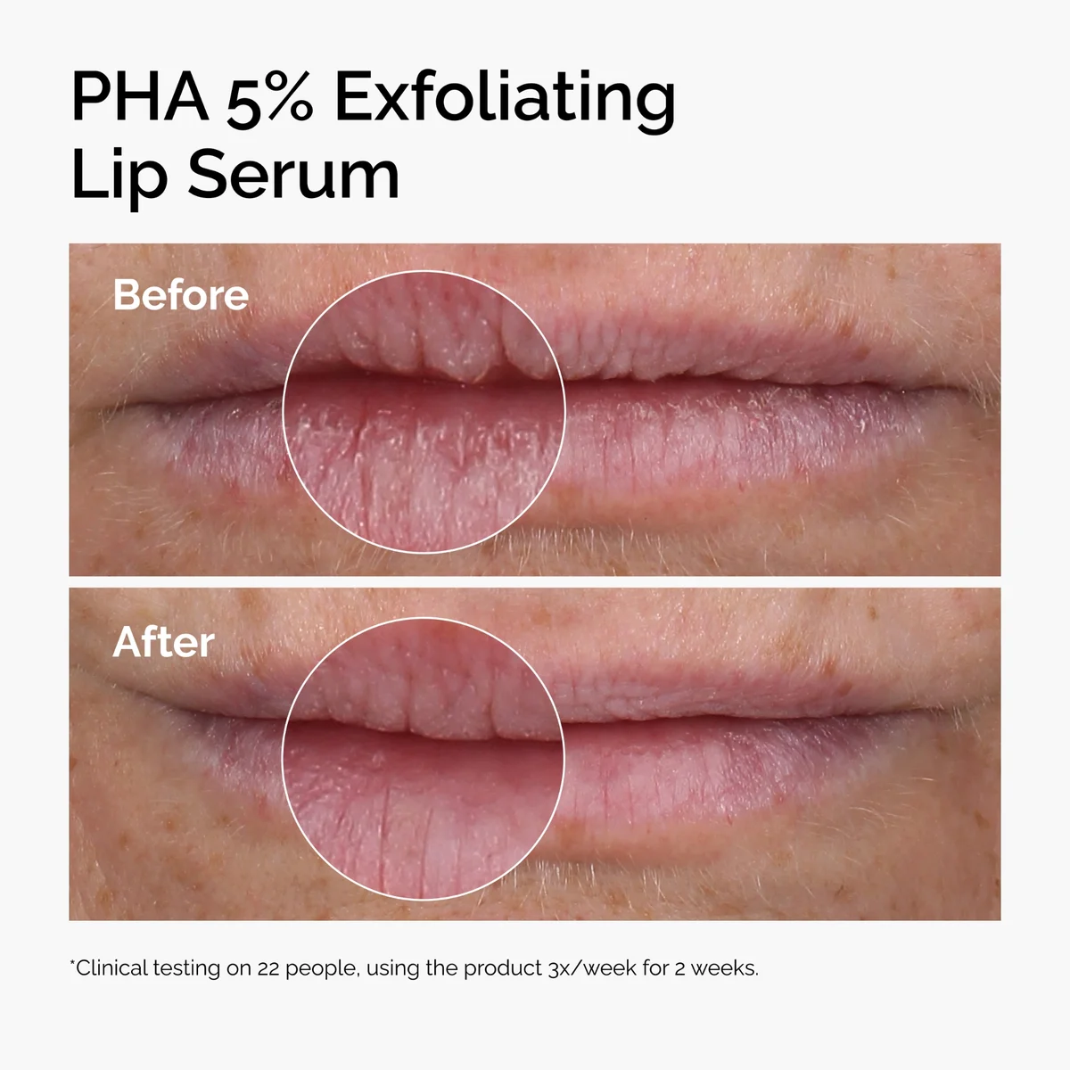 Купить THE ORDINARY PHA 5% Exfoliating Lip Serum на Beautystorage.ru. Быстрая доставка по России и СНГ.