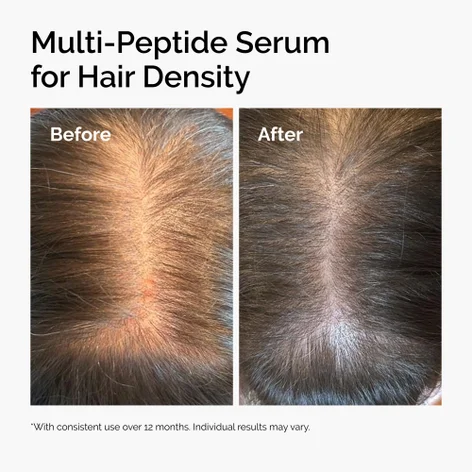 Купить THE ORDINARY Multi-Peptide Serum For Hair Density на Beautystorage.ru. Быстрая доставка по России и СНГ.