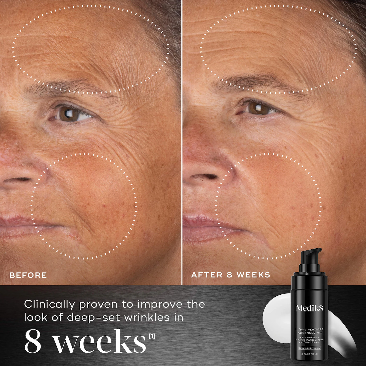 Купить MEDIK8 Liquid Peptides Advanced MP на Beautystorage.ru. Быстрая доставка по России и СНГ.