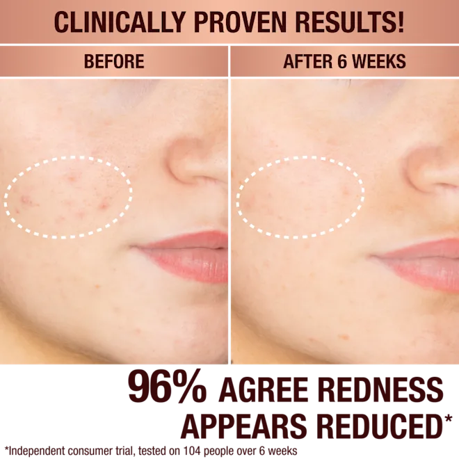 CHARLOTTE TILBURY Dark Spot Correcting Radiance Recovery Serum купить в Beauty Storage. Быстрая доставка по России и СНГ.