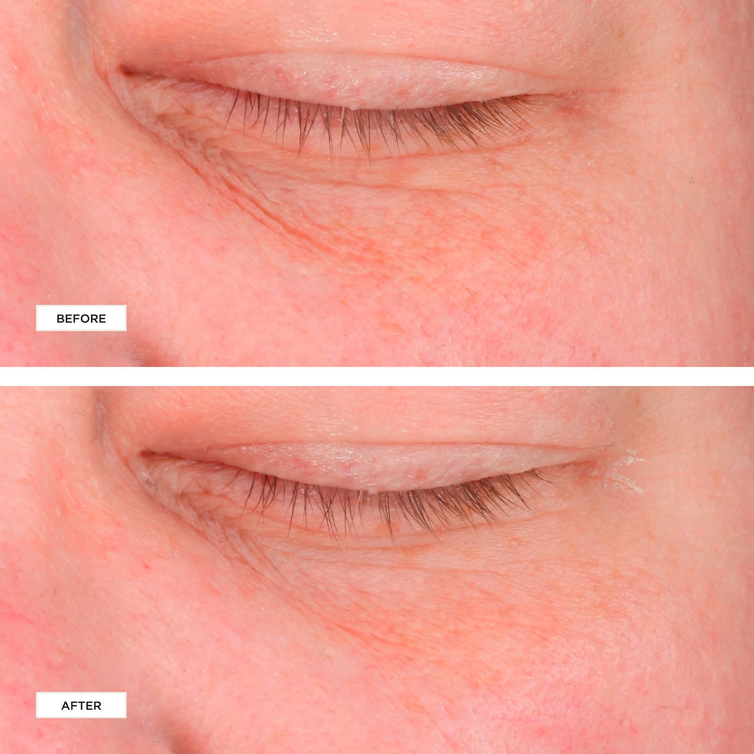 PERRICONE MD Cold Plasma+ Eye