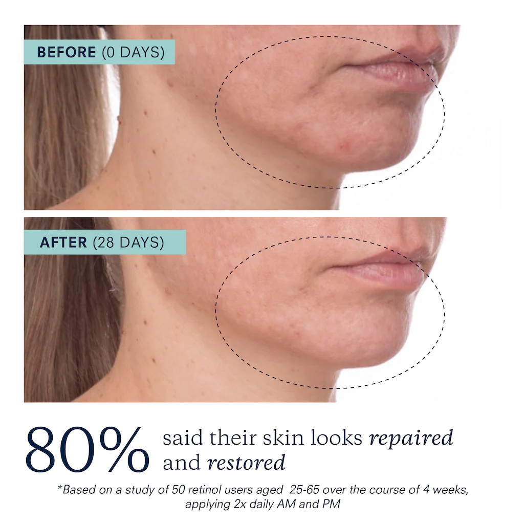 KORA ORGANICS Plant Stem Cell Retinol Alternative Serum купить в Beauty Storage. Быстрая доставка по России и СНГ.