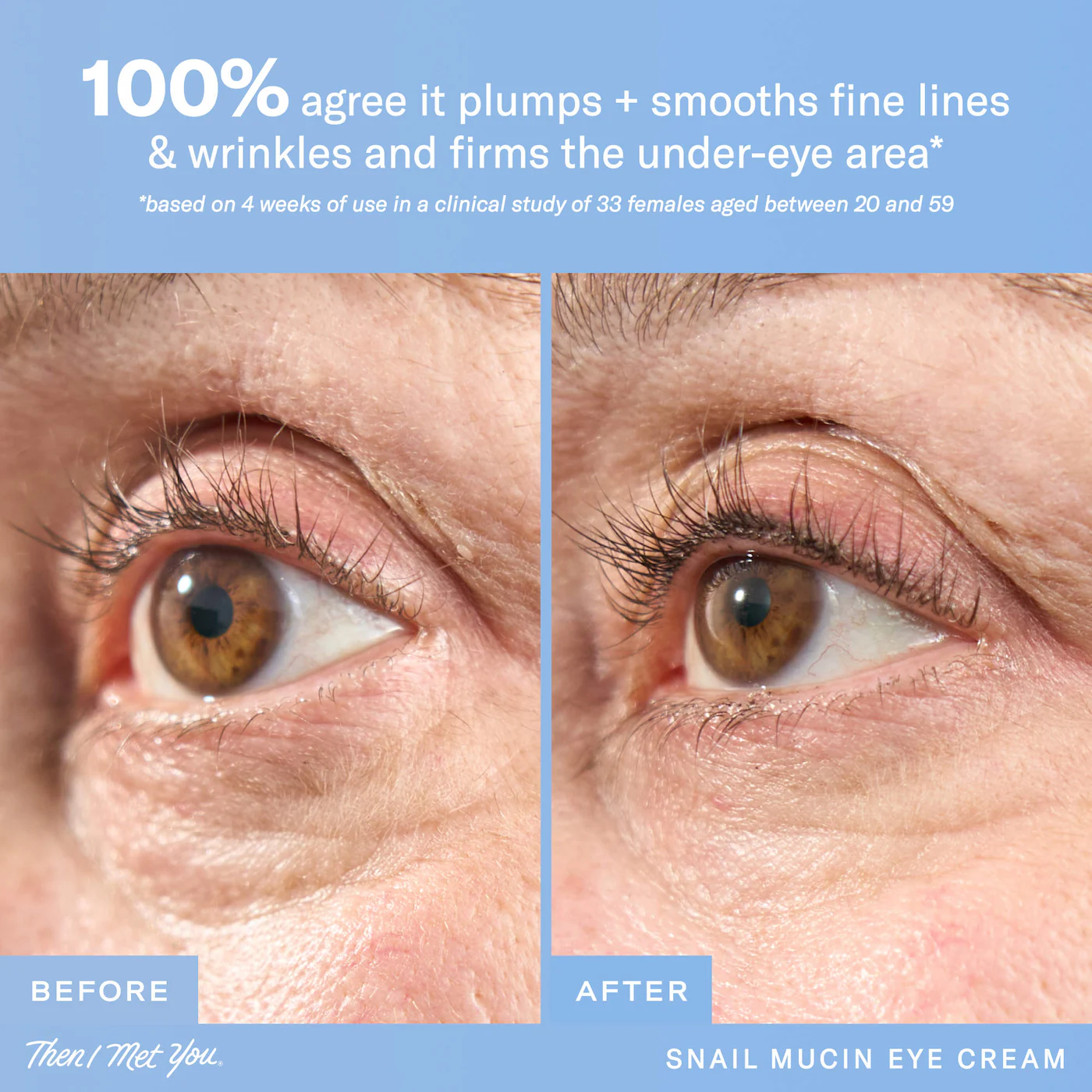 Купить THEN I MET YOU Snail Mucin Eye Cream на Beautystorage.ru. Быстрая доставка по России и СНГ.