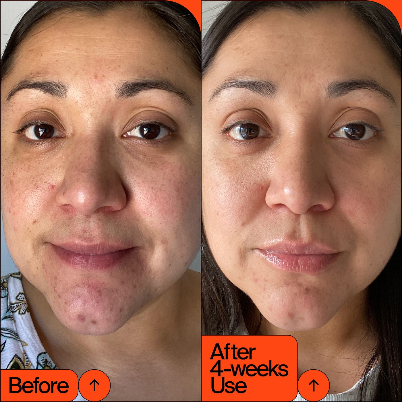 YOUTH TO THE PEOPLE 15% Vitamin C + Clean Caffeine Energy Serum купить в Beauty Storage. Быстрая доставка по России и СНГ.
