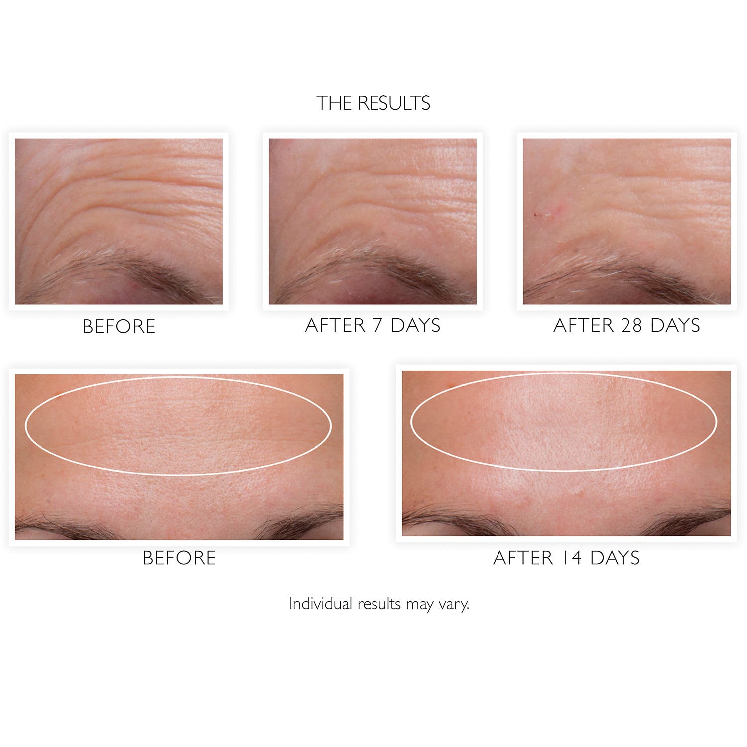 PETER THOMAS ROTH Hungarian Thermal Water Mineral-Rich Moisturizer