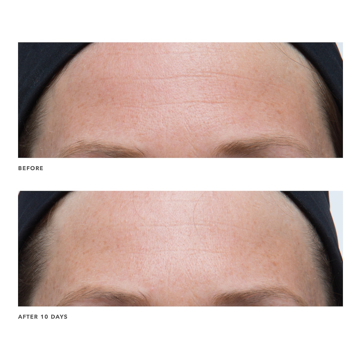 ALGENIST POWER Advanced Wrinkle Fighter Moisturizer купить в Beauty Storage. Быстрая доставка по России и СНГ.