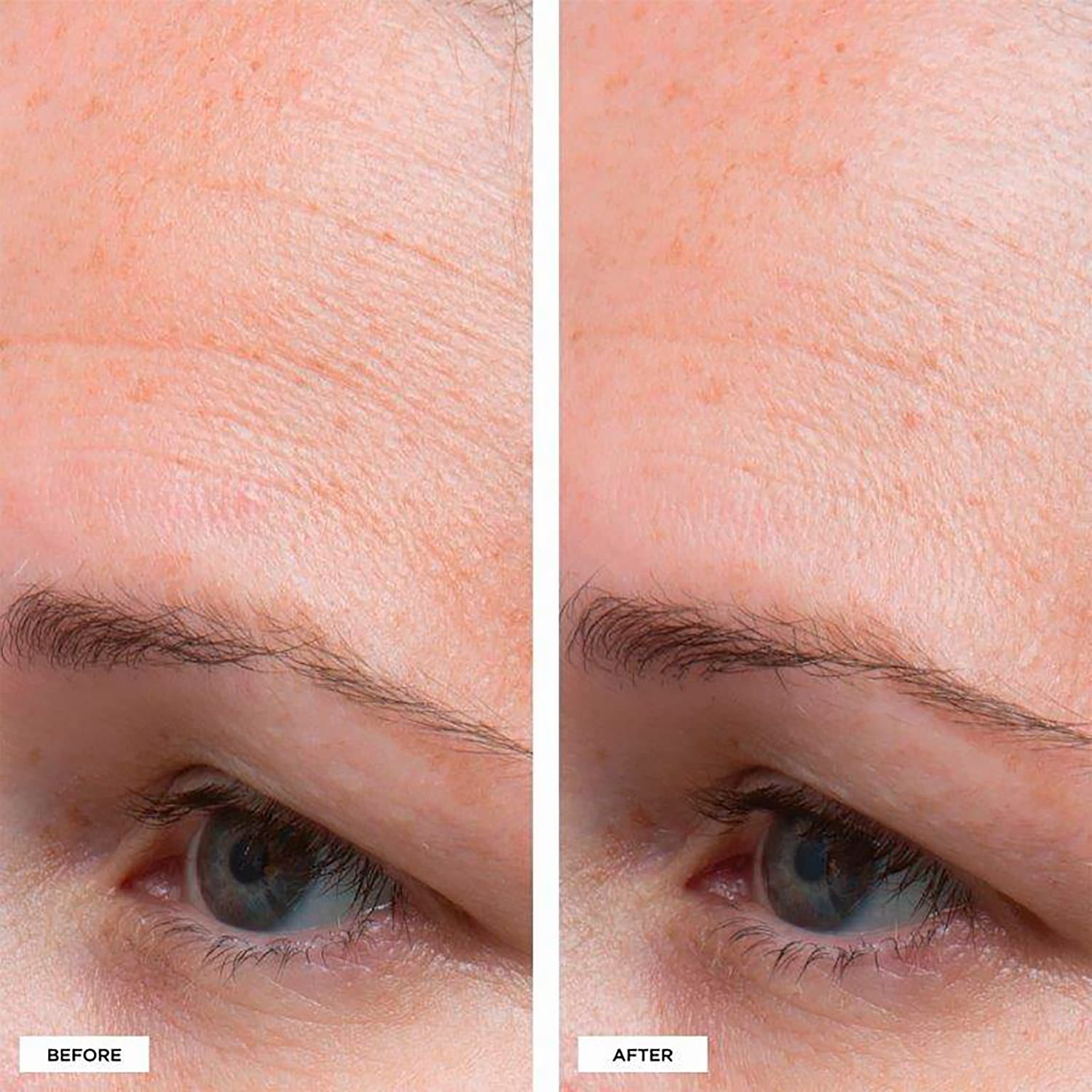 PERRICONE MD High Potency Classics: Hyaluronic Intensive Moisturizer