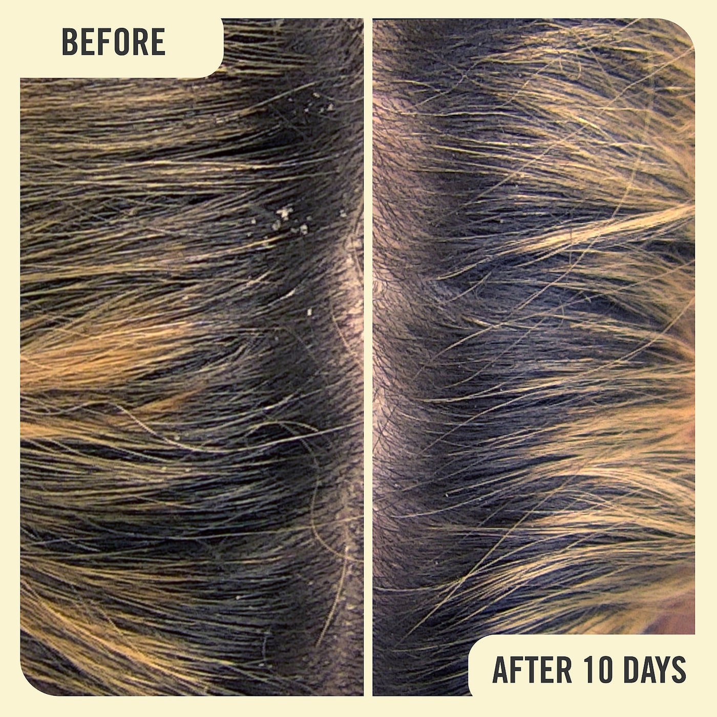 FIRST AID BEAUTY Anti-Dandruff Scalp Serum with 2% Salicylic Acid купить в Beauty Storage. Быстрая доставка по России и СНГ.
